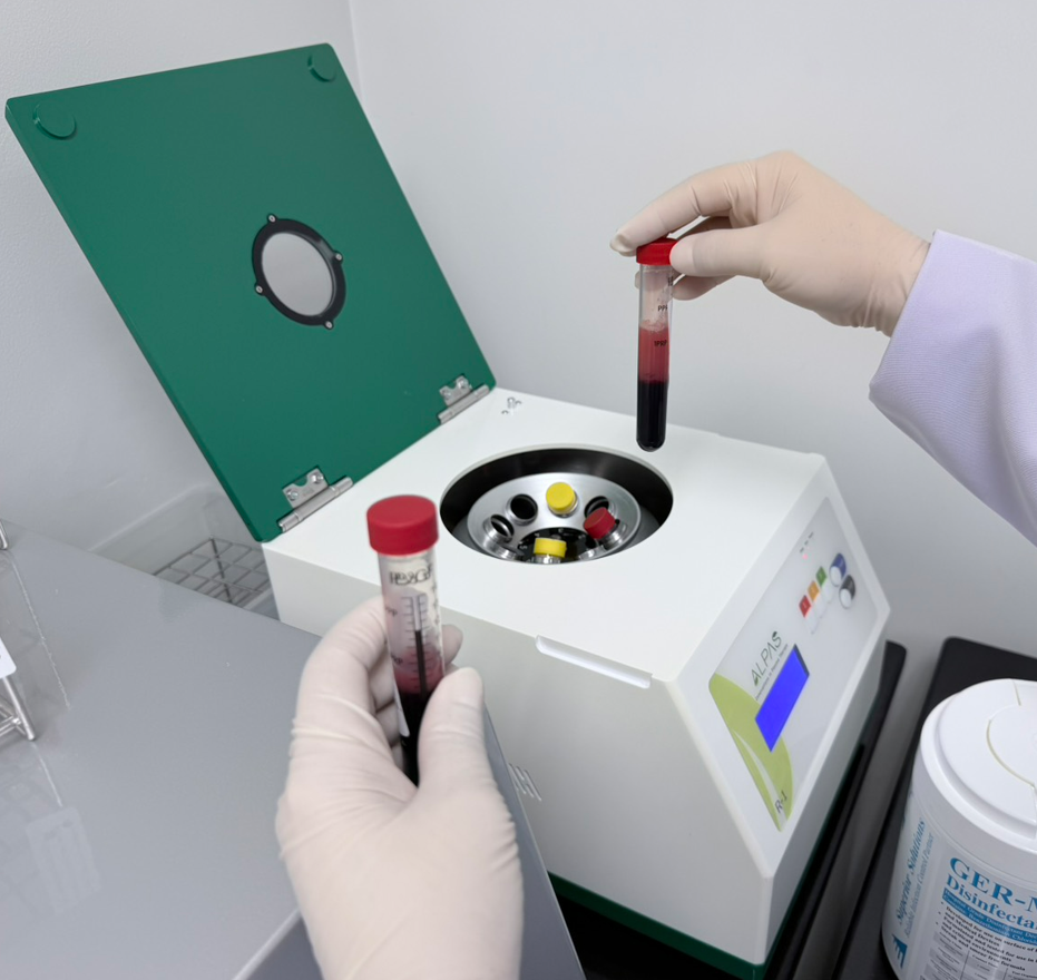 การปั่นแยกเลือดด้วยเครื่องควบคุมอุณหภูมิสำหรับ Plasma1®